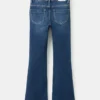 Jeans mit Knöpfen